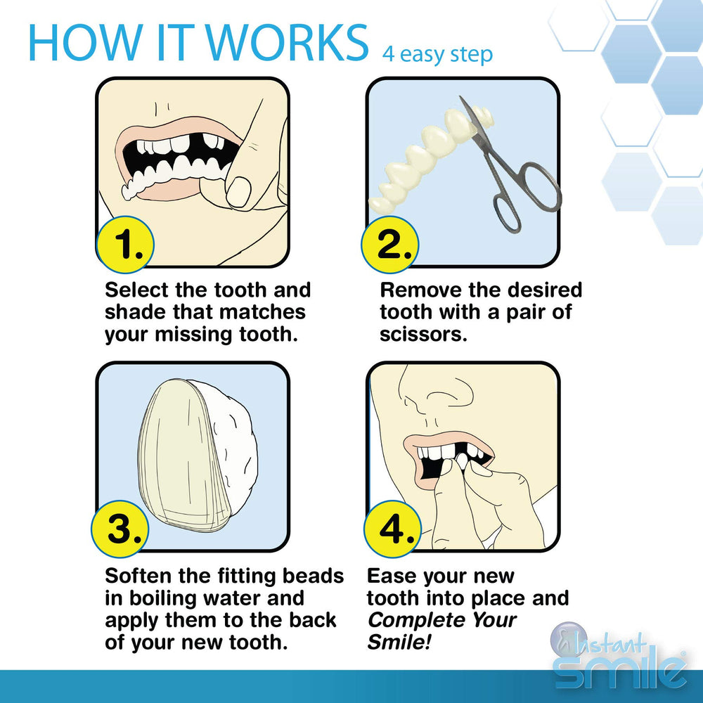 Instant Smile being used to replace a missing tooth