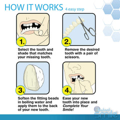 Instant Smile being used to replace a missing tooth