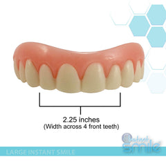 Instant Smile Large Size veneer - product overview