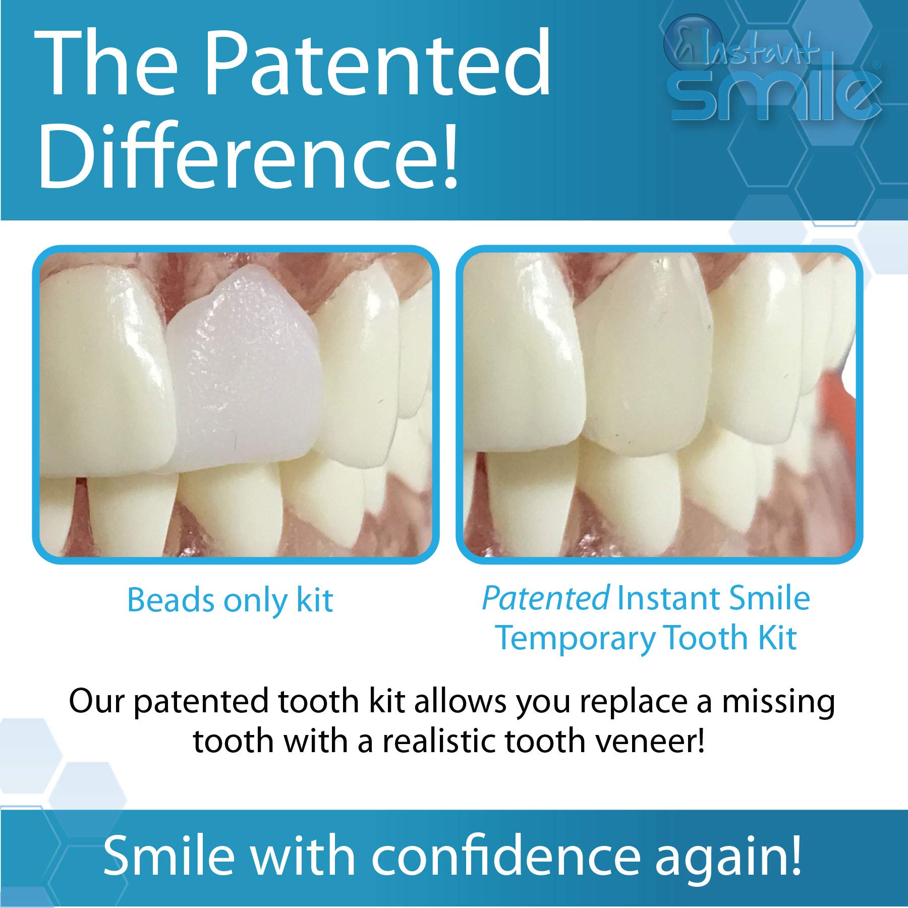 Shaping and trimming tools included with Instant Smile kit