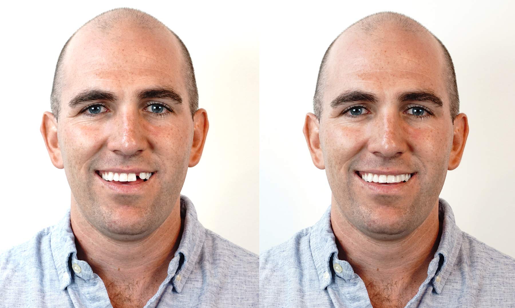 Three shade options included for natural matching