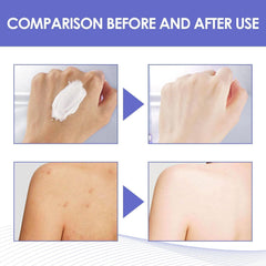Intimate Area Dark Spot Corrector bikini line application