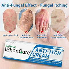 Ishancare anti-itch cream application on skin demonstrates quick itch relief usage.