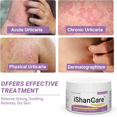 ishancare urticaria cream packaging front highlights natural herbal formula