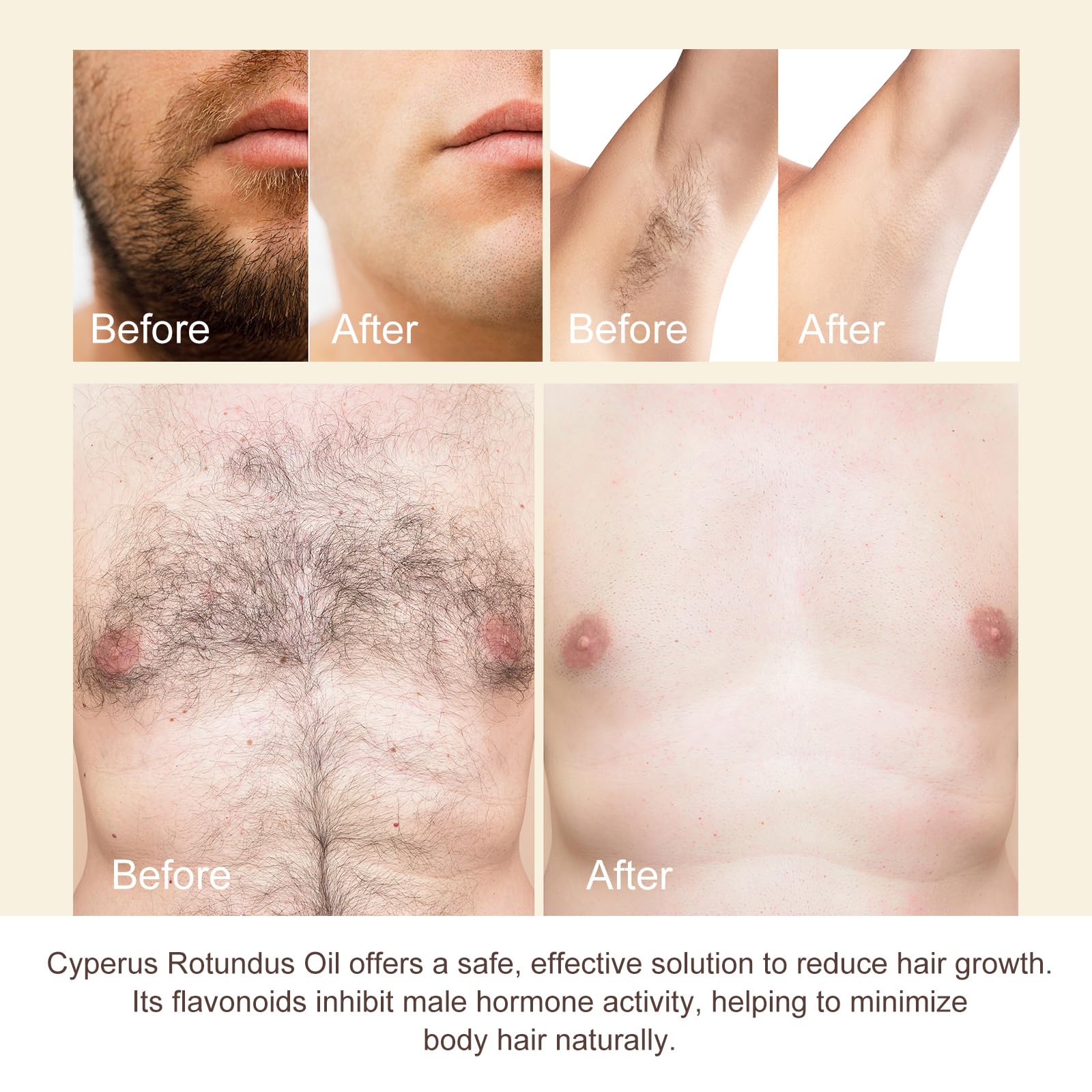 ITSDAWN Cyperus Rotundus Oil massaged underarms for smoother skin.