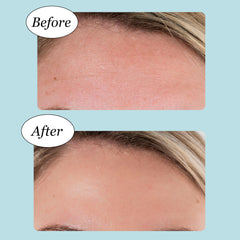 Box of JANE VINE Forehead Wrinkle Patches with 20 patches