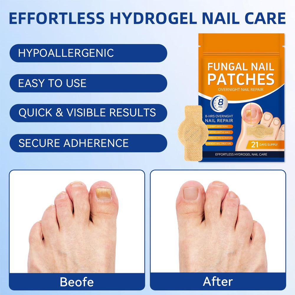 JoyJar patch prepared for bedtime routine on toe for simple nail care.