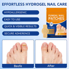 JoyJar patch prepared for bedtime routine on toe for simple nail care.