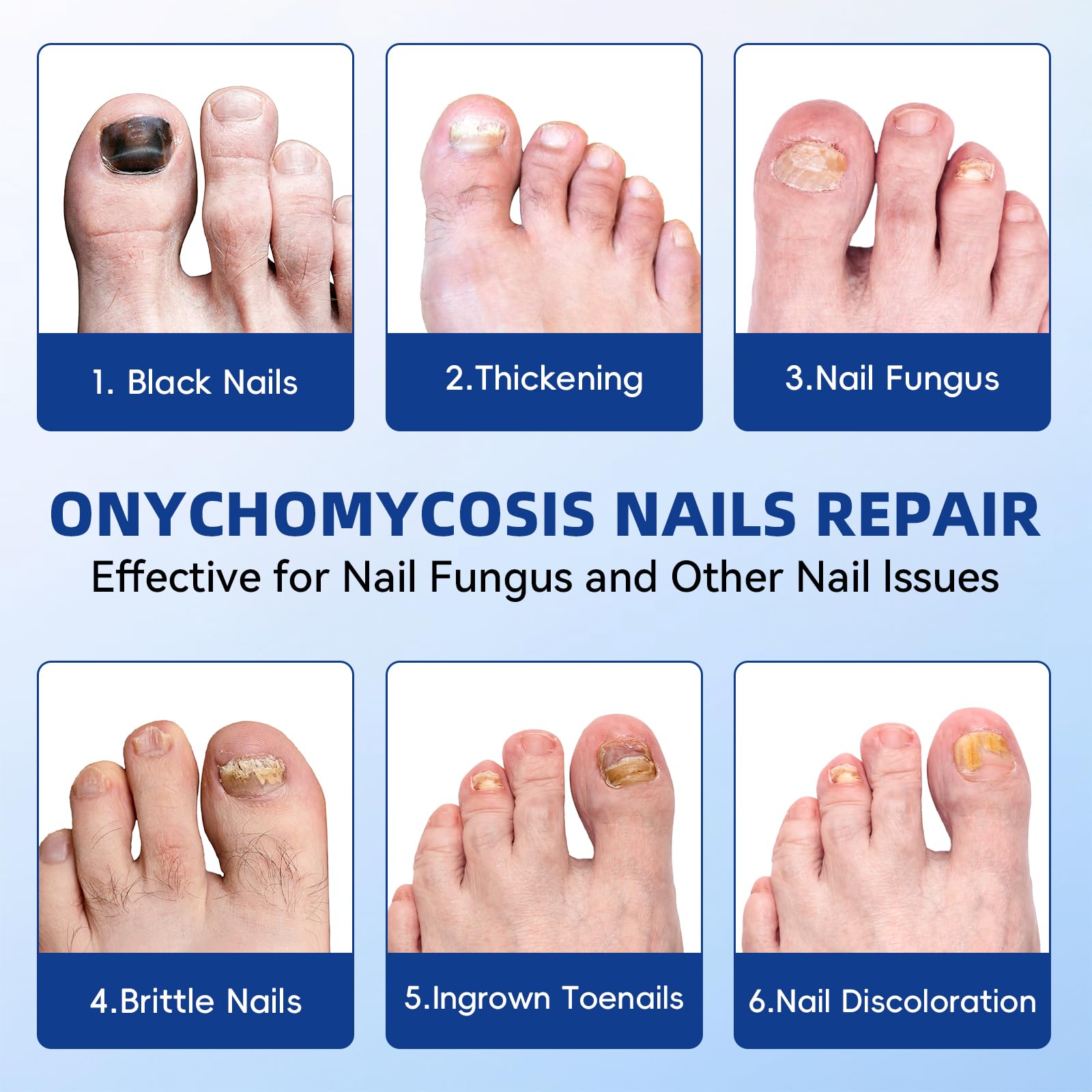 JoyJar patch covers the nail surface to help even out texture for a smoother look.