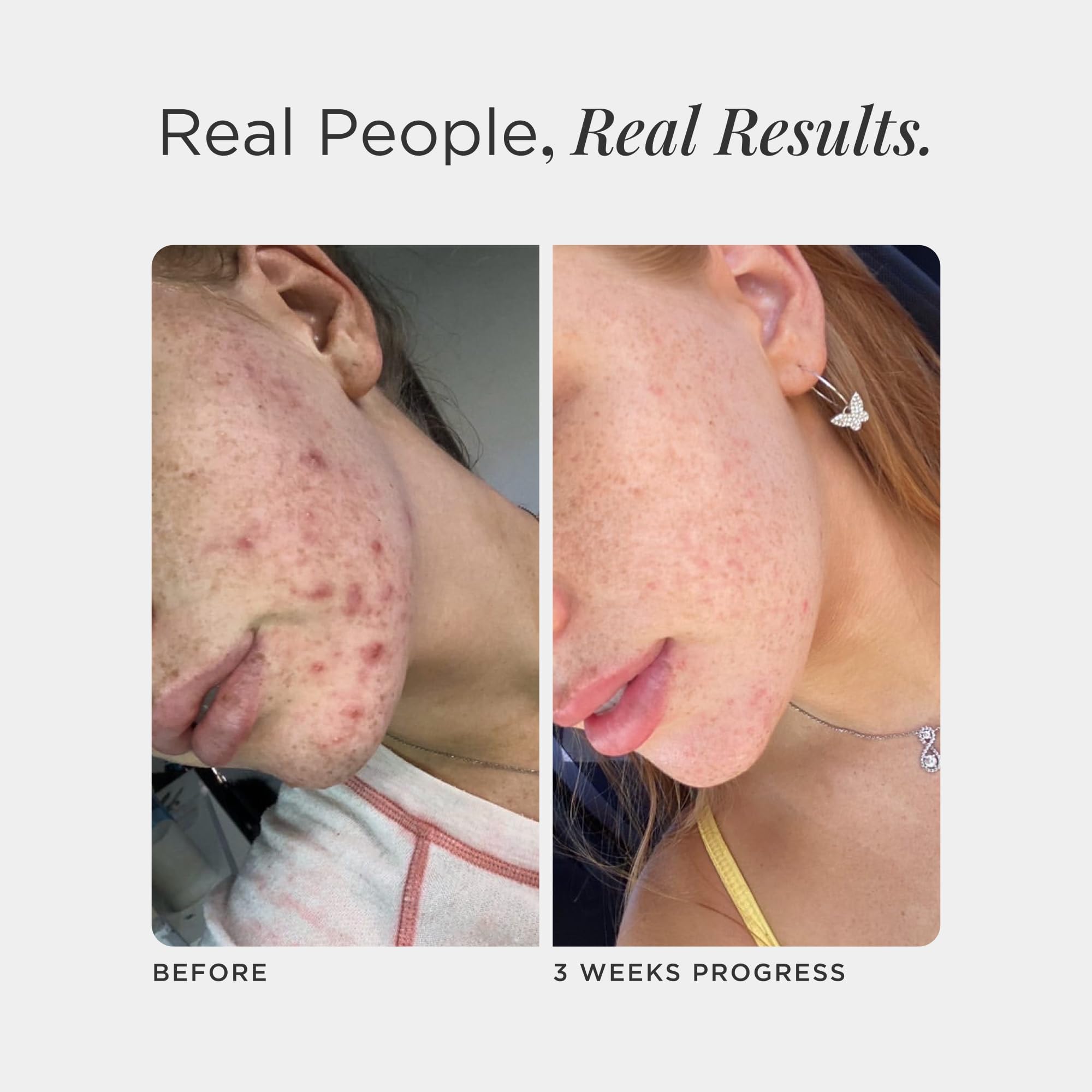 Teens and adults using JSHealth Skin and Digestion Formula
