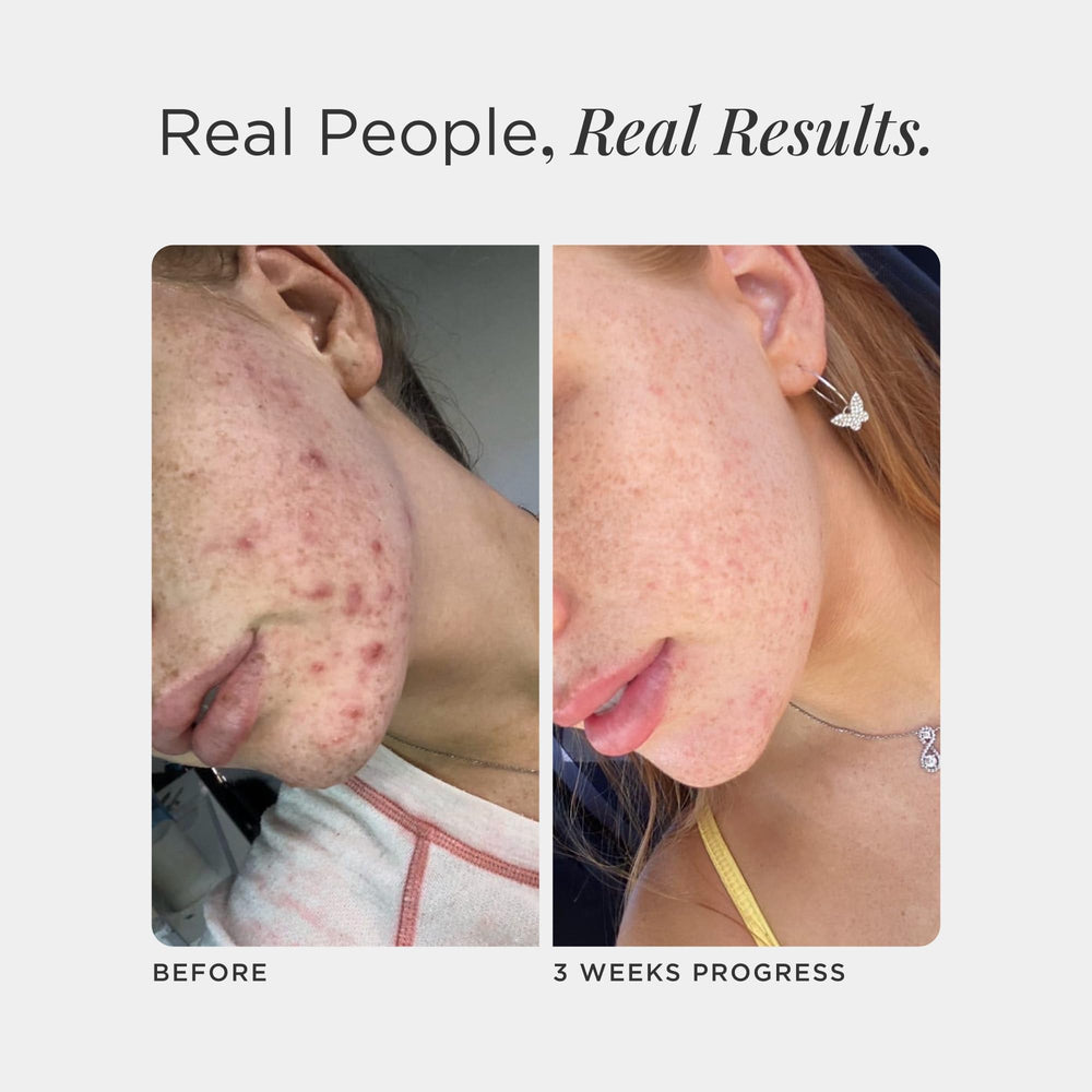 Teens and adults using JSHealth Skin and Digestion Formula
