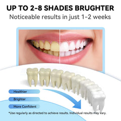 Five 3ml whitening gel tubes laid out
