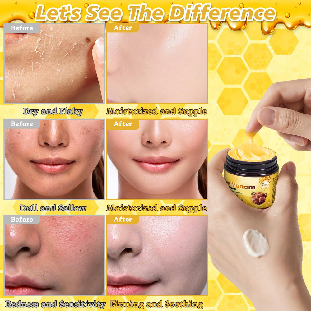 Juanchi Bee Venom Cream fits daily skincare routine.