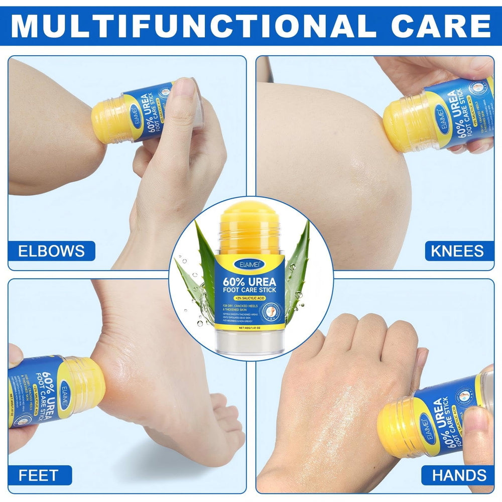 JWBVCTCR 60% urea helps smooth calluses and dry patches.