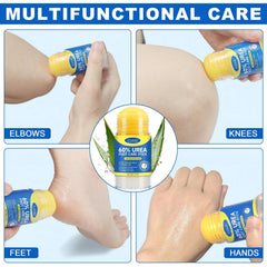 JWBVCTCR 60% urea helps smooth calluses and dry patches.