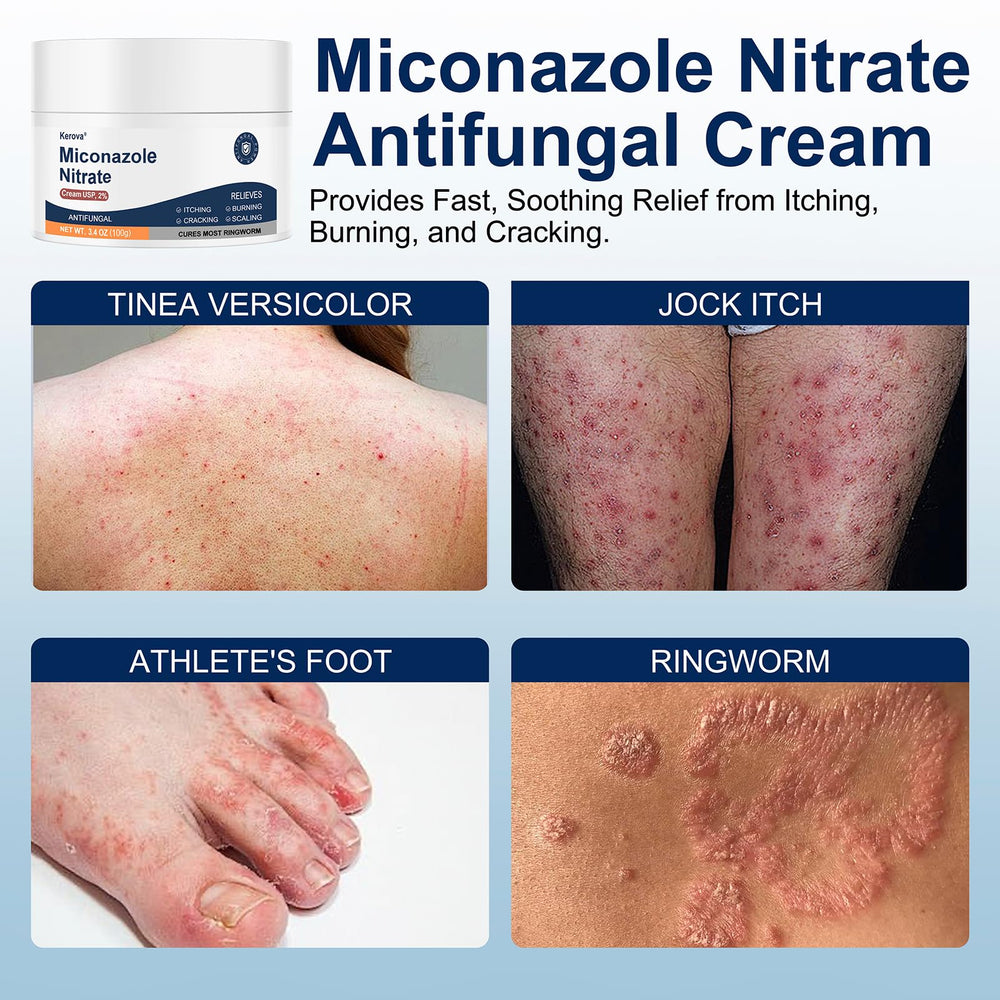 Kerova antifungal cream packaging closeup reveals dosage for reliable use