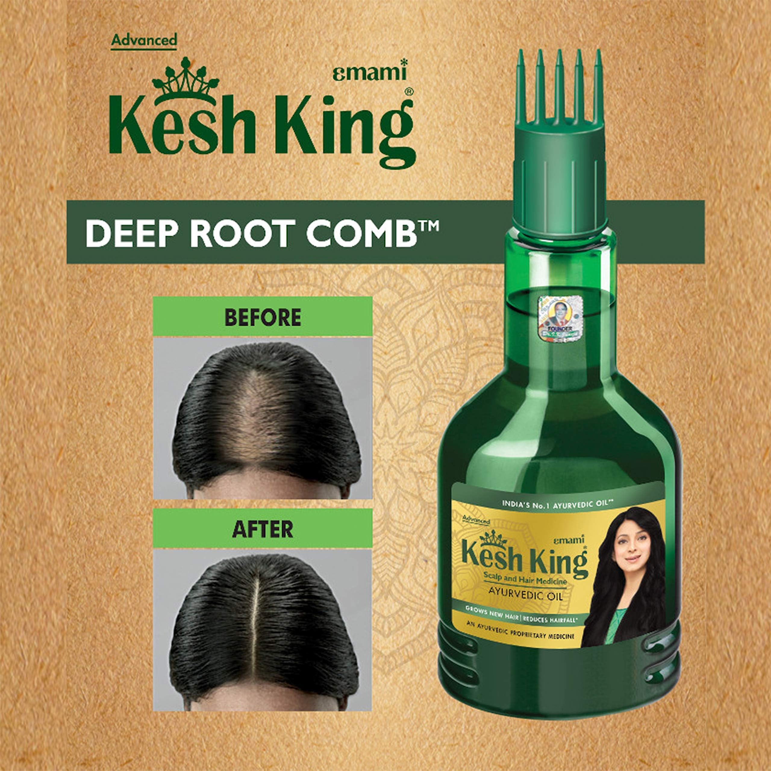 Graphic showing hair growth with Kesh King