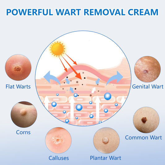 KIbabyDI Wart Remover application tip showing gentle cryotherapy