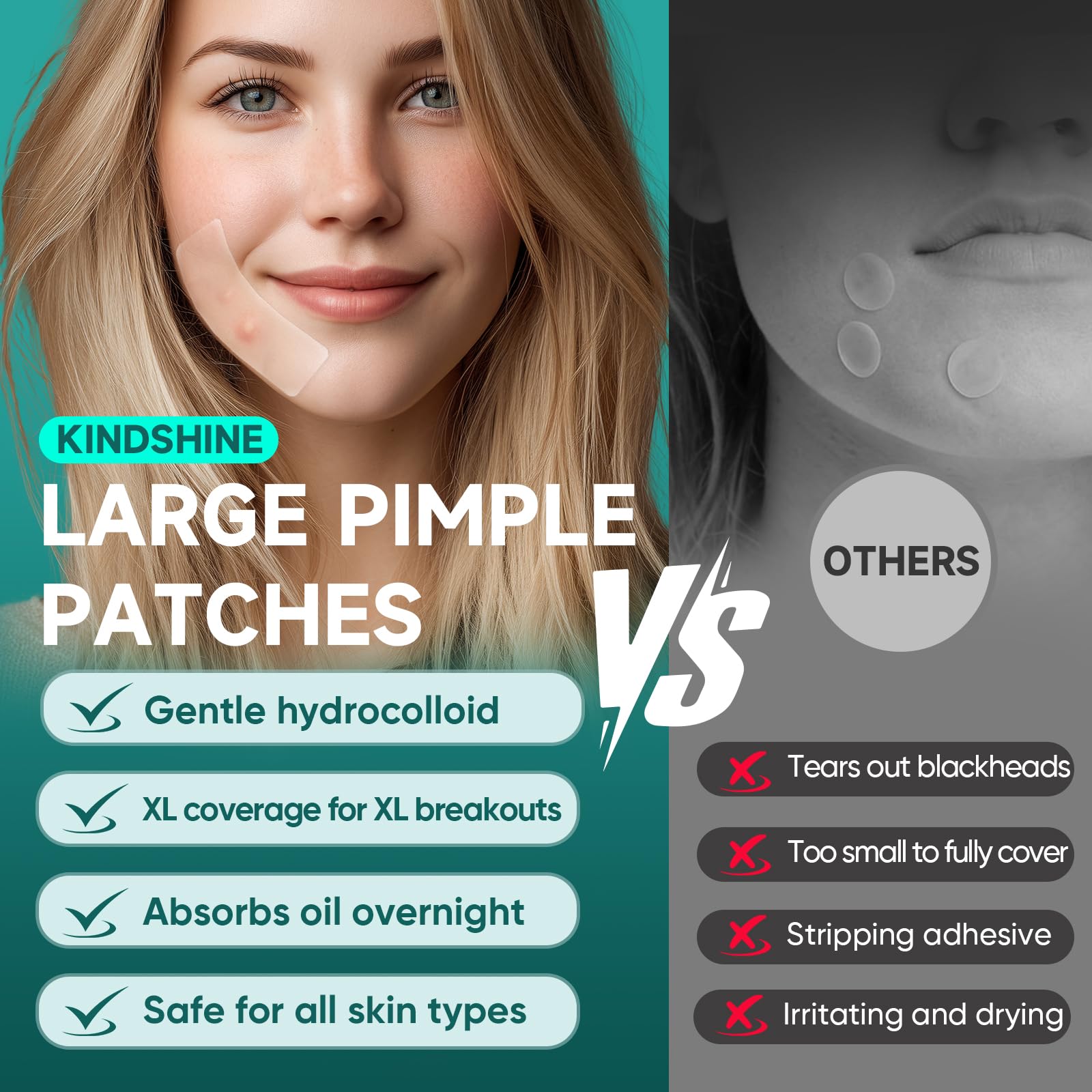 Kindshine patches cover chin, back, and forehead areas for versatile use.