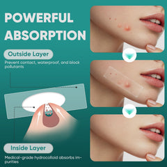 Kindshine patches worn under makeup for discreet daytime use.
