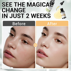 KIUORET 6-peptide booster serum bottle supports firmness and smoother skin