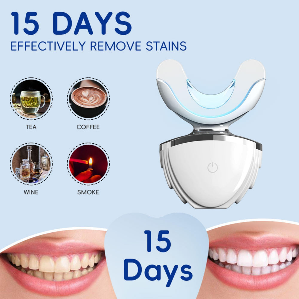 Before and after whitening results comparison image