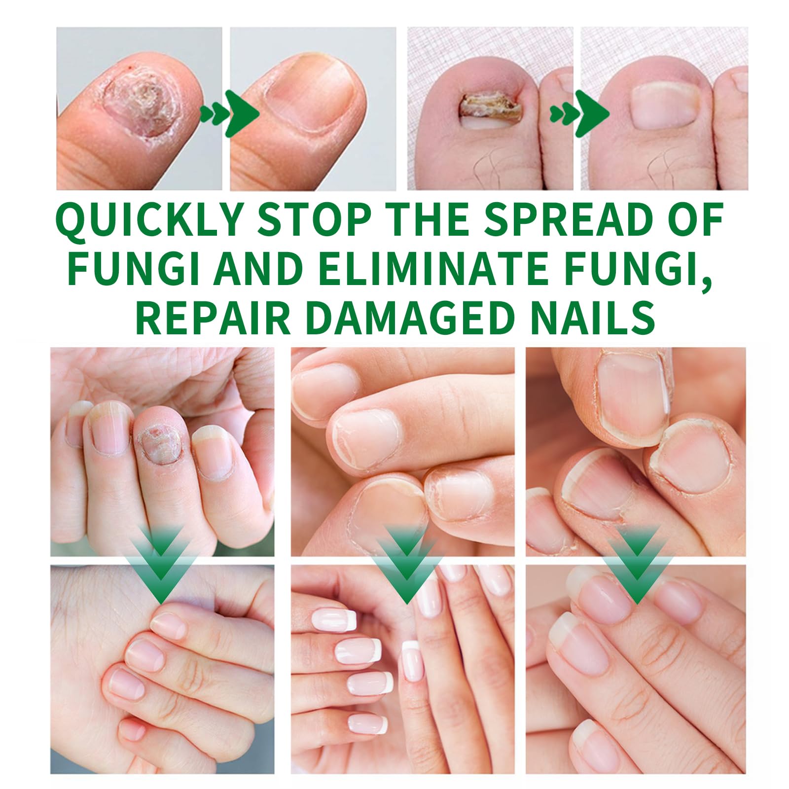 KUNLEN Multi-Purpose Nail Repair Oil Serum bottle for nourishing care.