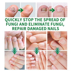 KUNLEN Multi-Purpose Nail Repair Oil Serum bottle for nourishing care.
