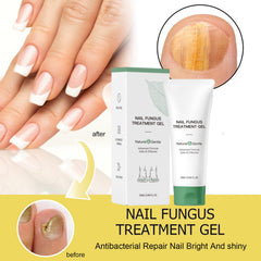 KUNLEN Nail Fungus Cream tube close-up highlighting mild ingredients.