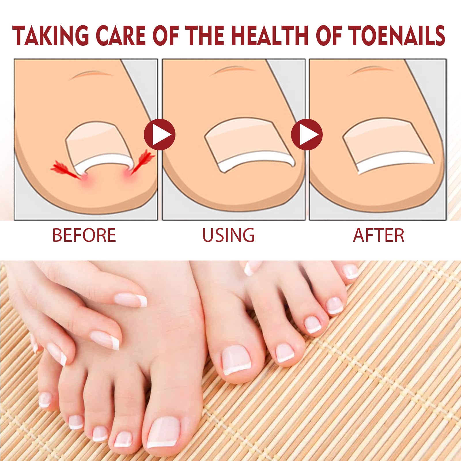 KUNLEN Nail Growth Hydration application image showing quick absorption.