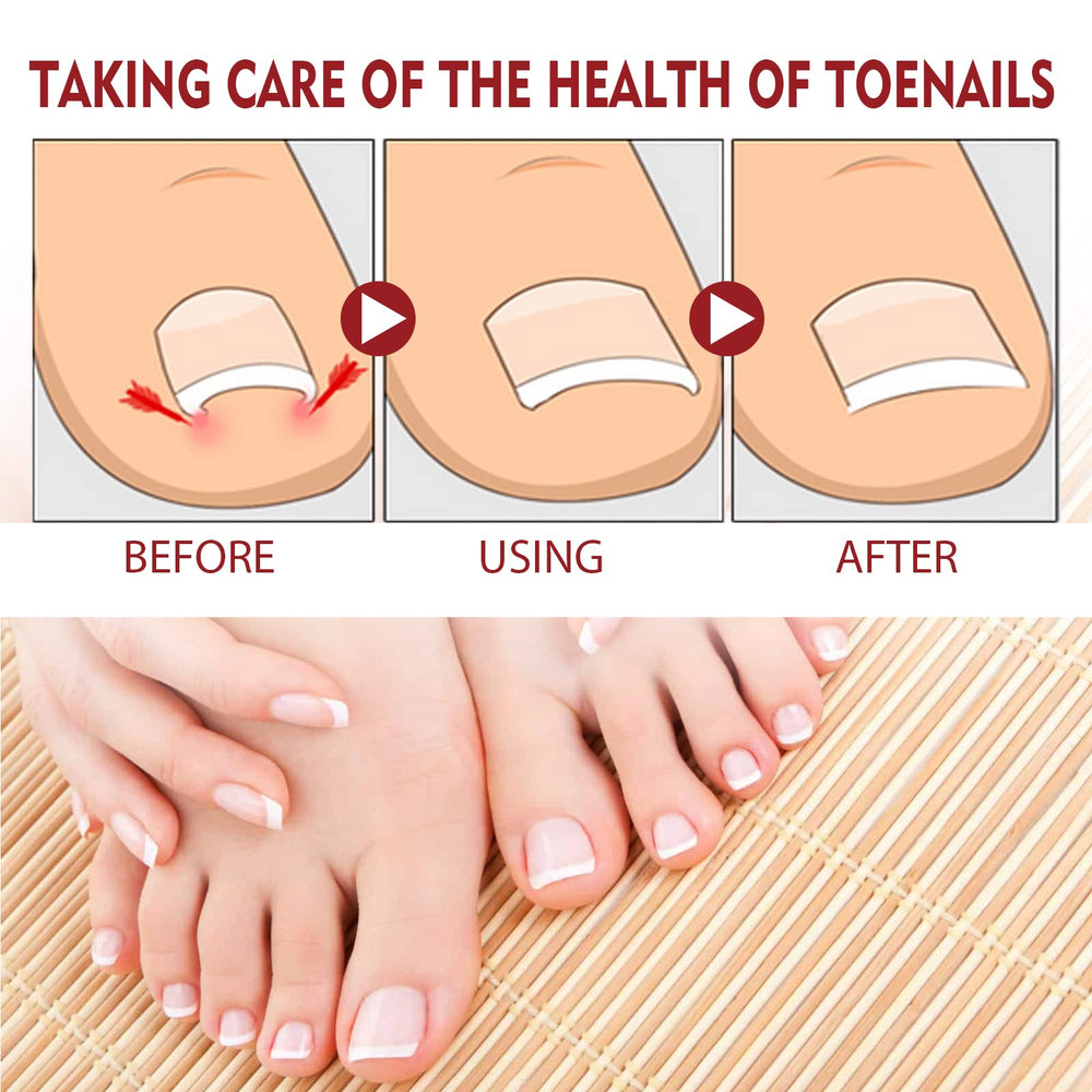 KUNLEN Nail Growth Hydration application image showing quick absorption.