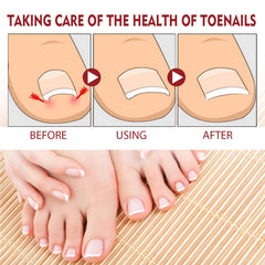 KUNLEN Nail Growth Hydration application image showing quick absorption.