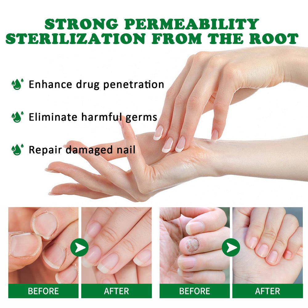 KUNLEN Hydration close-up reveals smooth, healthy-looking nails.