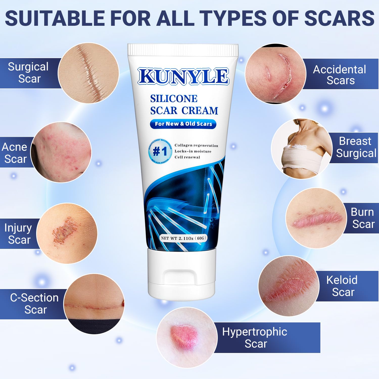 Kunyle Scar Cream applied to scar area showing smoothing progress