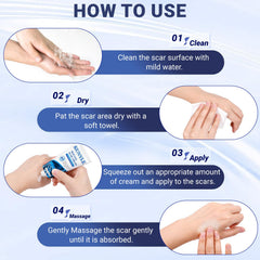 Kunyle Scar Cream box packaging highlighting silicone-based formula