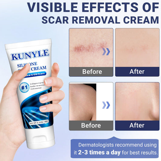 Close-up of Kunyle Scar Cream texture for easy absorption