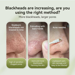 LANBENA nose strips being applied on the nose for cleansing.