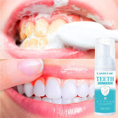 Foam cleaning action showing tartar removal and gum care
