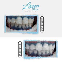 LaserGlow brand logo