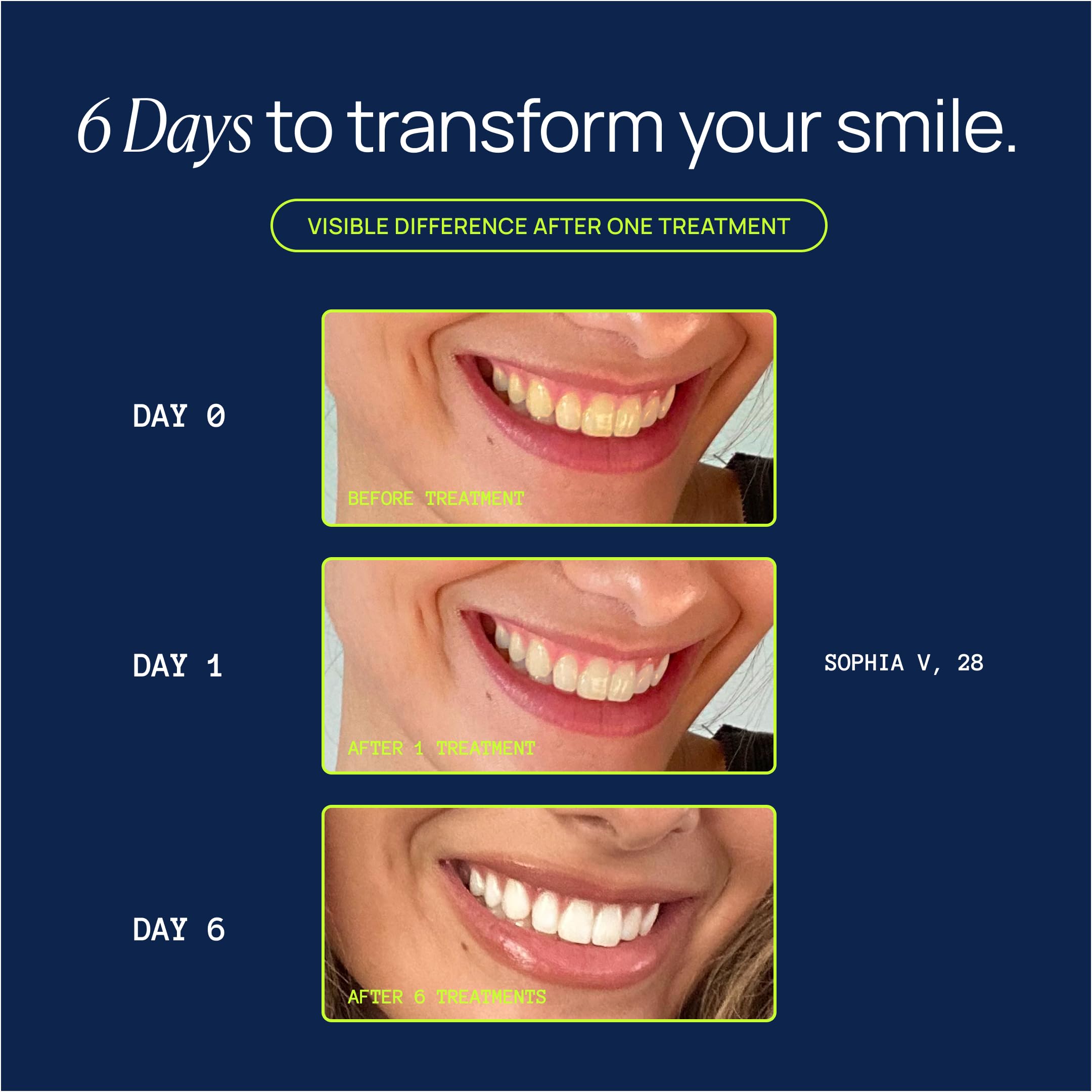 Laughland Original Teeth Whitening Gel 3 Pack packaging