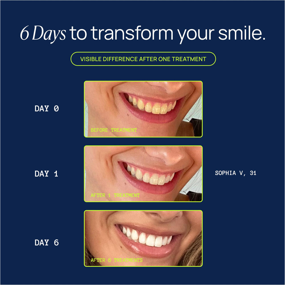 Pre-measured whitening gel syringes