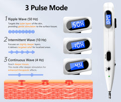Diagram of three stimulation modes: ripple, intermittent, continuous
