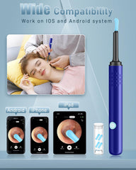 LENGIN ear wax camera wifi access enables wireless photo and video capture.