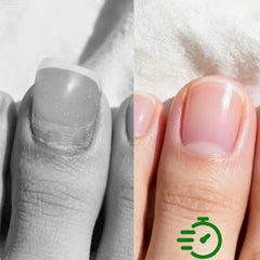 LEWELLRY nail-strengthening serum helps prevent splitting and peeling over time.