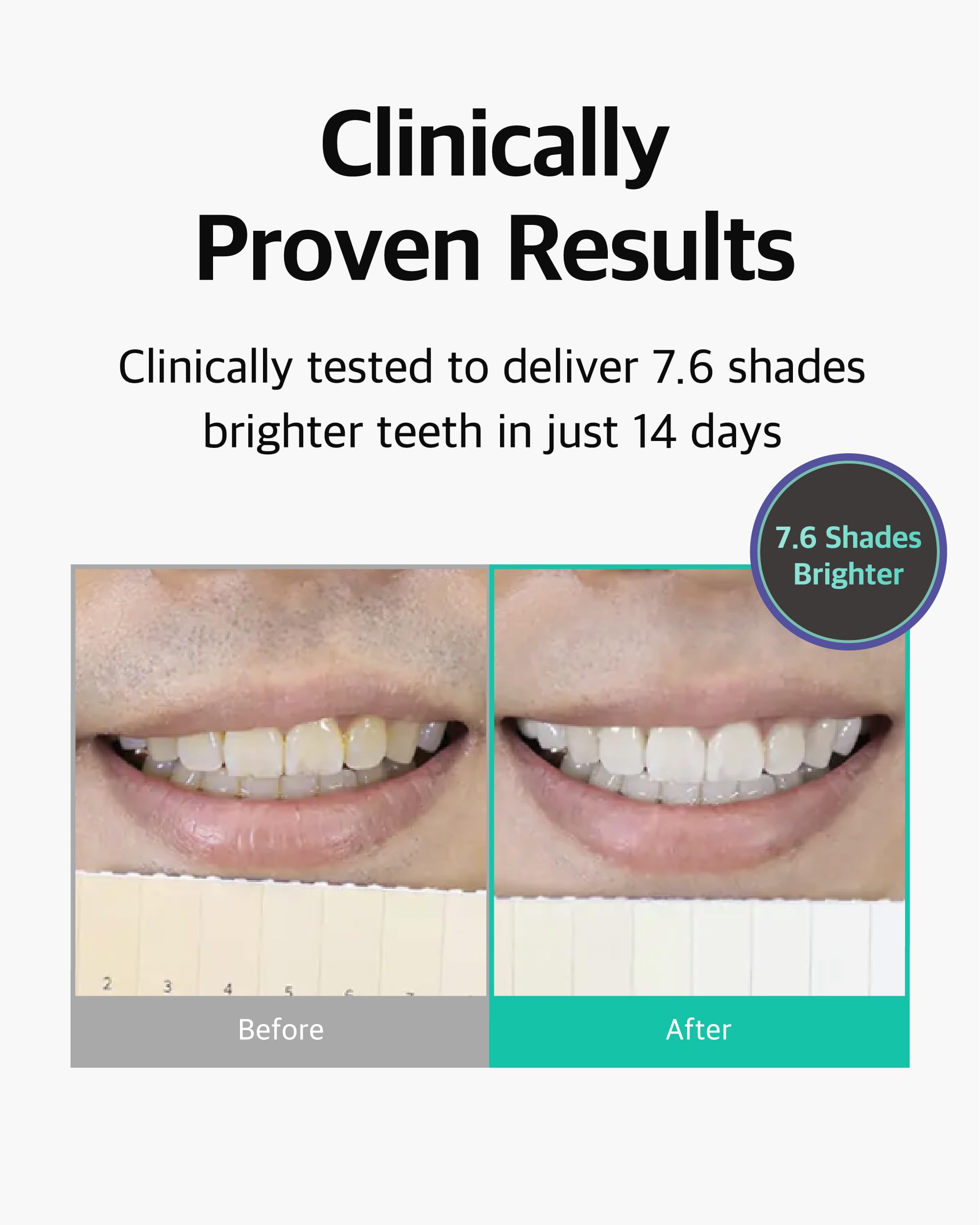 Pack of three LiveOrals whitening sets
