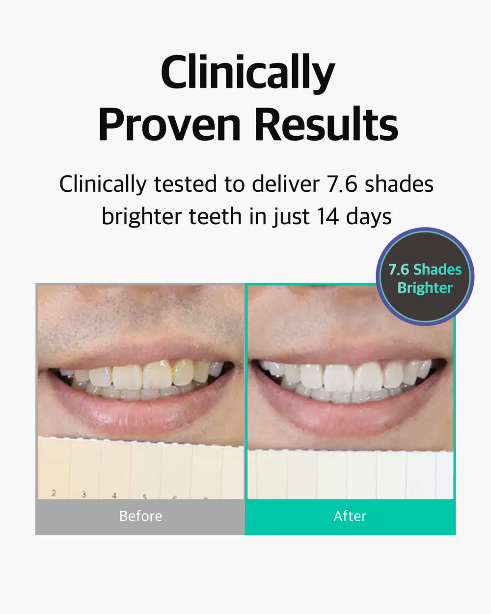Pack of three LiveOrals whitening sets