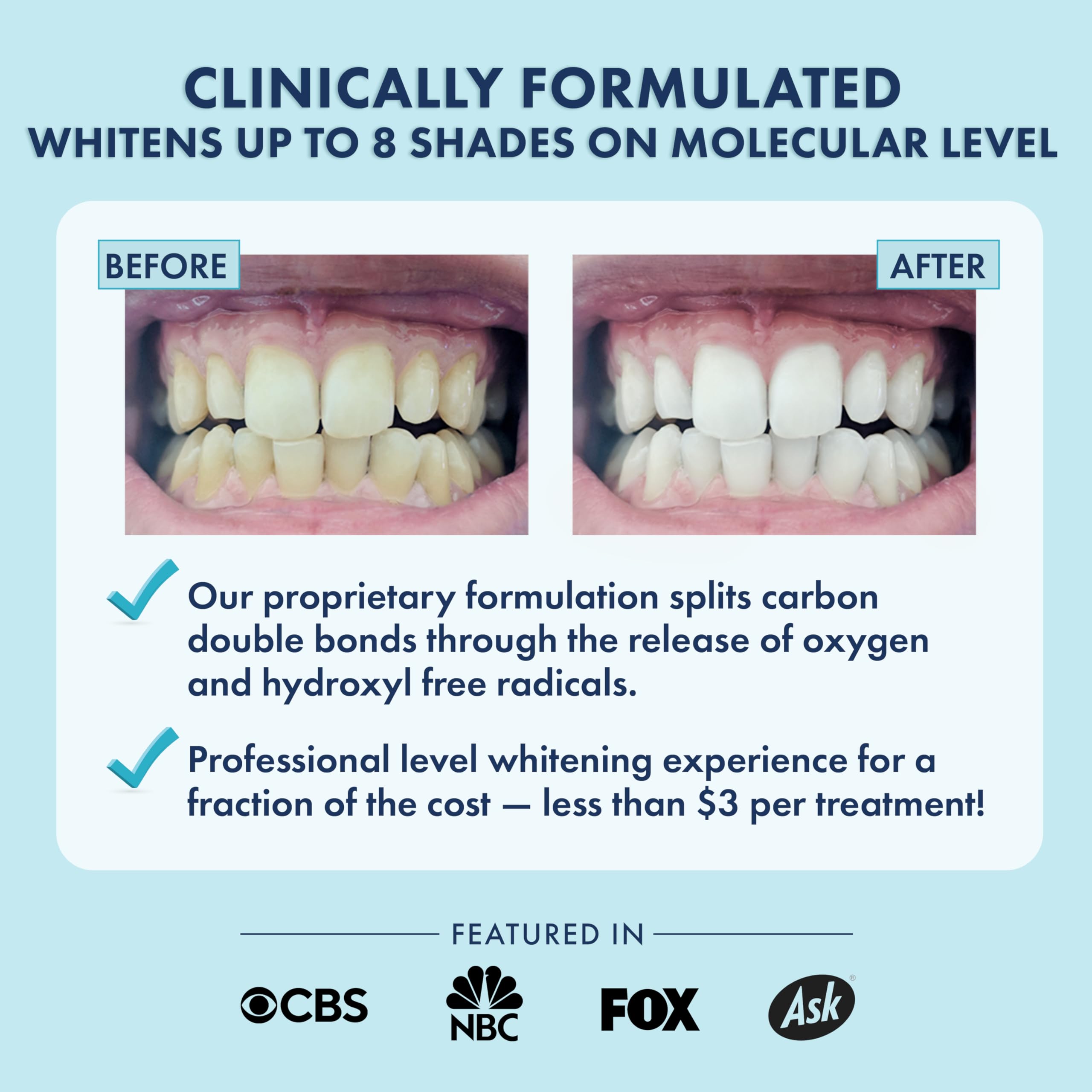 Close up of LIVFRESH whitening strips applied to teeth