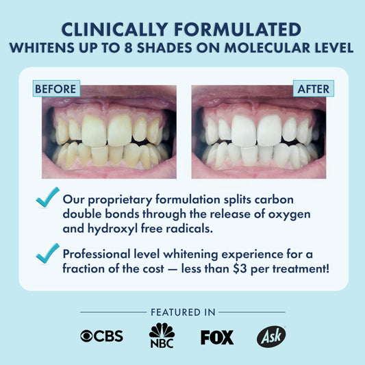 Close up of LIVFRESH whitening strips applied to teeth