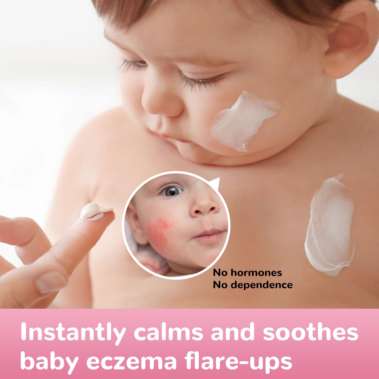 LMNOOP Baby Eczema Relief Cream being gently dabbed onto skin for soothing comfort