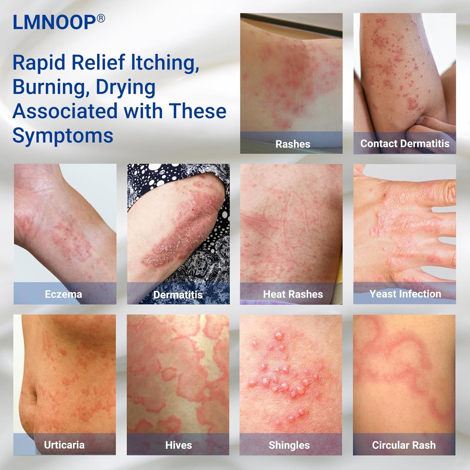 LMNOOP eczema cream application on arm demonstrates fast-absorbing relief for itchy skin.